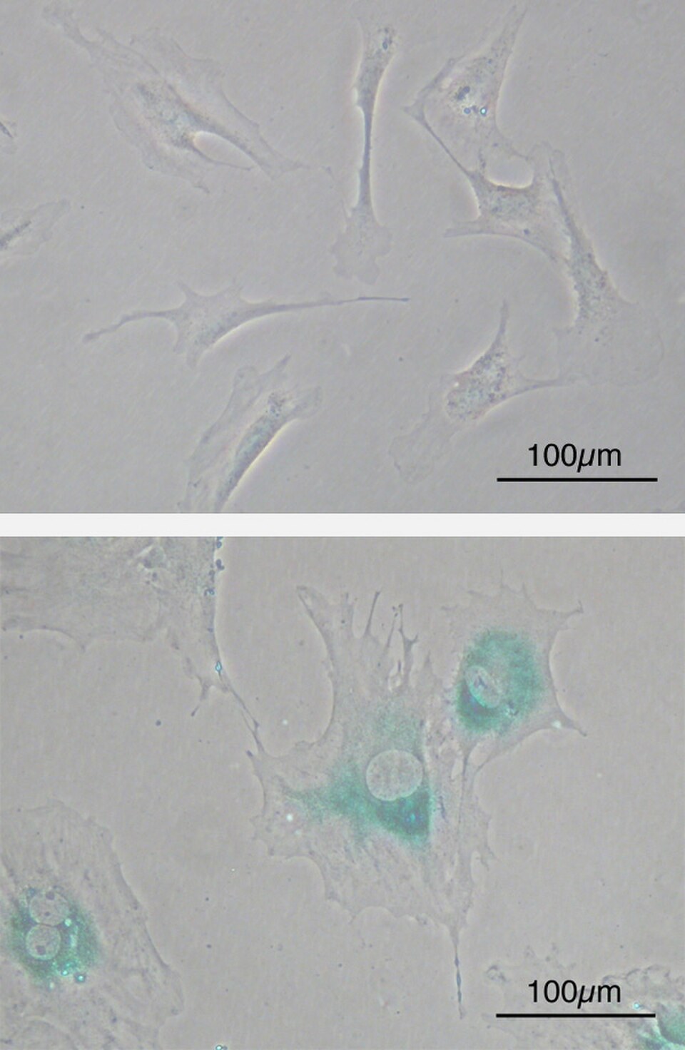 Micrografías de fibroblastos embrionarios de ratón con tinción de beta-galactosidasa asociada a senescencia