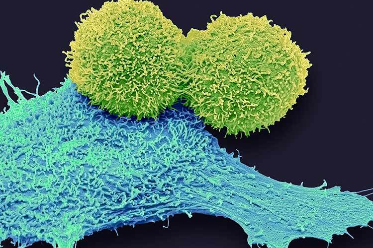 Colourised microscopic image of several cells attached to tissue